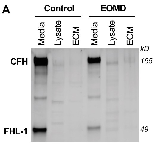 CFH and FHL-1 proteins were largely secreted, with slight retention in the ECM.jpg
